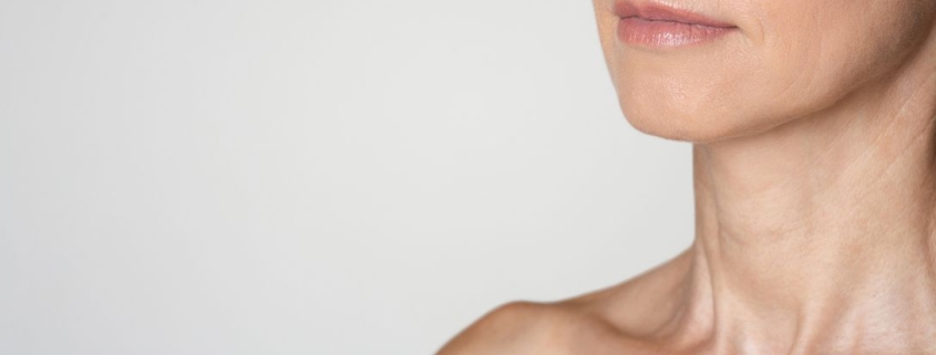 Rughe su collo e décolleté cosa fare