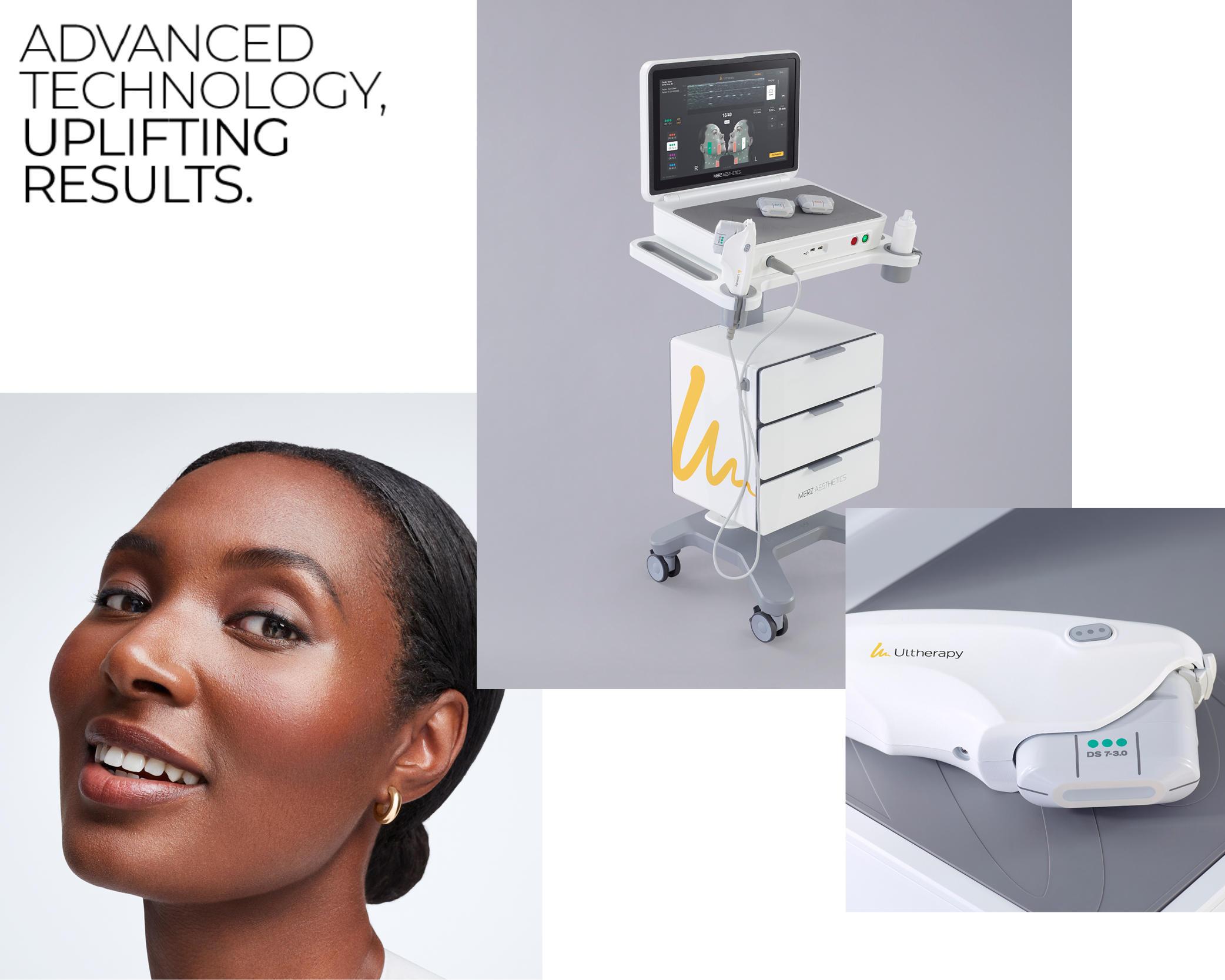 Come agisce Ultherapy PRIME® - Lifting non invasivo